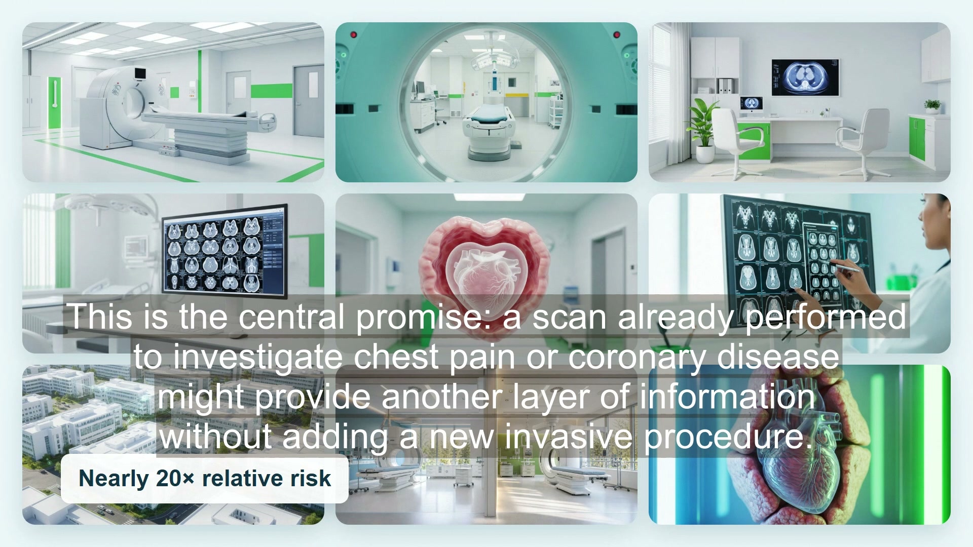 Heart imaging visual from an explainer about AI analysis of cardiac CT scans